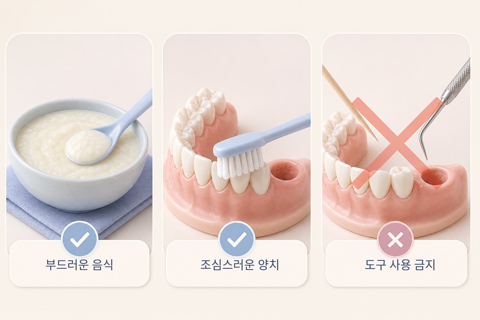 부드러운 음식, 조심스러운 양치, 발치 부위에 도구를 대지 않는 원칙을 세 장면으로 나눈 그림